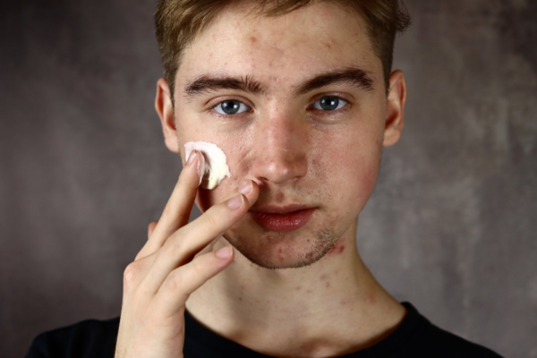 young-man-applying-mmuk-man-anti-acne-1200x800